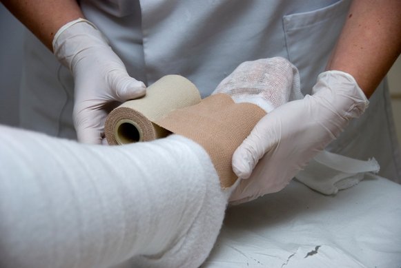 Burn Injury Related Disability Discrimination